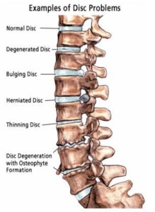 examples-of-disc-problems
