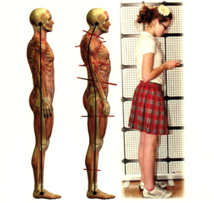 teens+forward+head+posture