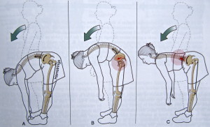flexion9