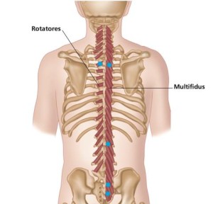 Multifidi trigger points