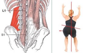 Gluteus vs Quadratus