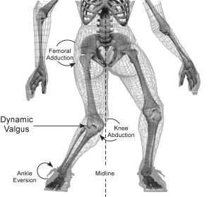 dynamic-valgus