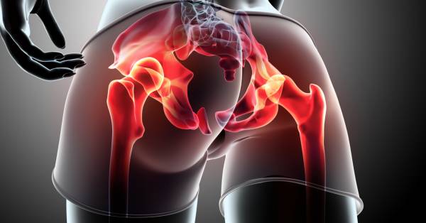 artróza a posilovna artroza deformată a articulației cotului cu 2 grade